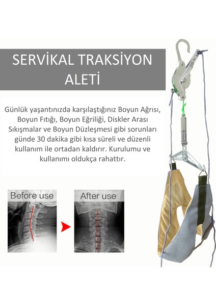 Boyun Düzleşmesi ve Boyun Fıtığı Önleyici Servikal Traksiyon Aleti