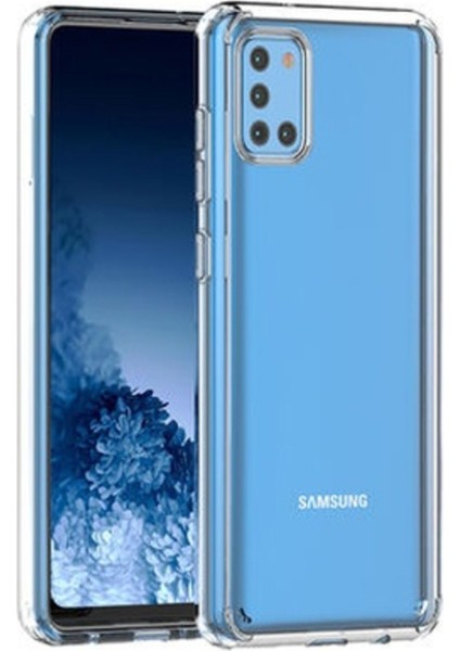 Samsung Galaxy A31 Kılıf Coss Acrylic Tpu