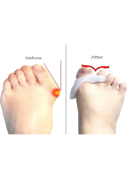 Iki Parmaklı Makaralı Bunyon %100 Silikon - Türk Malı fırsatları