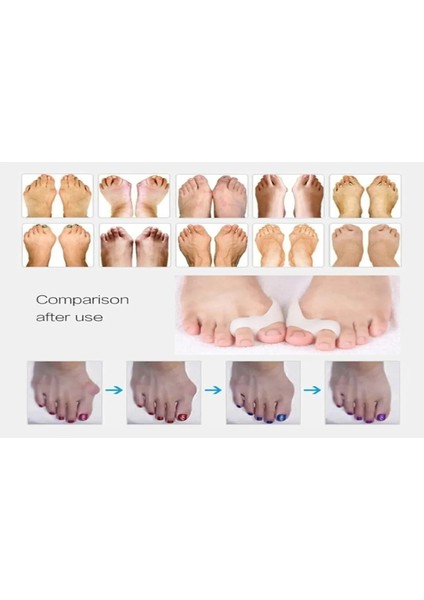 Iki Parmaklı Makaralı Bunyon %100 Silikon - Türk Malı indirimleri