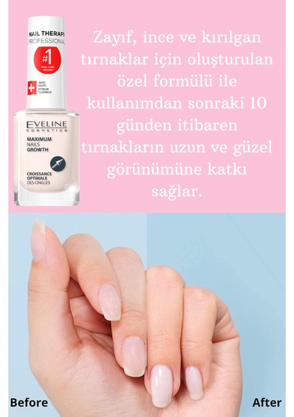 Eveline Maximum Nails Growth Ultra Keratin+ Ipek Tırnak Bakım Ürünü 12 ml