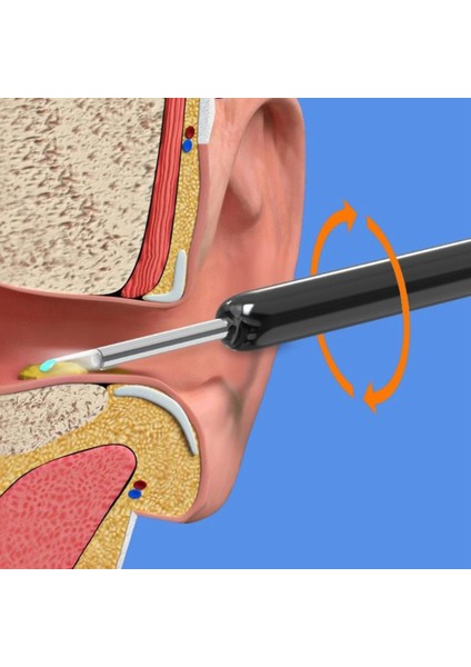 Akıllı Kulak Temizleme Endoskopu Görsel Kulak Sopaları Endoskop 500 W Earpick Mini Kamera Otoskop Android -A (Yurt Dışından)
