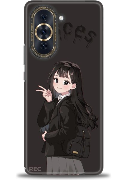 Huawei Nova 10 Uyumlu Kılıf Hd Kalite Desenli Baskılı Kılıf - x (85)