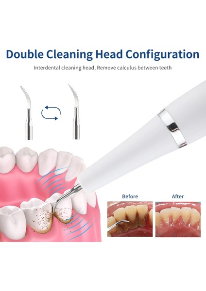 Bir Stil Ultrasonik Diş Ölçekleyici Diş Beyazlatma Irrigator Diş Taşı Sökücü Tartar Sökücü Plak Lekeleri Temizleyici Ağız Bakımı Diş Cleane (Yurt Dışından)