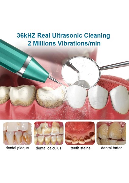 Yeşil Stil Diş Ölçekleyici Diş Tartar Sökücü Ultrasonik Temizleme Diş Plak Diş Taşı Sökücü Sonic Diş Temizleyici Diş Taşı Temizleme (Yurt Dışından)