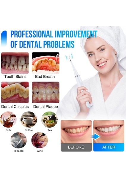 Siyah Stil Diş Tartar Sökücü Ultrasonik Diş Temizleyici Diş Beyazlatma Ölçekleyici USB Elektrikli Diş Fırçası Diş Taş Temizleme Oral Irrigators (Yurt Dışından) modelleri