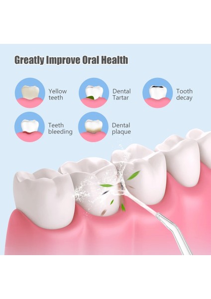 Yeşil Stil Oral Irrigator Diş Su Jeti Diş Beyazlatma Temizleyici Su Flosser Dişler Için Taşınabilir Irrigator Dişler Için Su Ipliği 4 Ipuçları (Yurt Dışından)