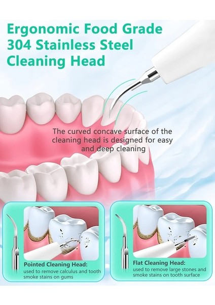 No.1 Stili Elektrikli Sonic Diş Taşı Ölçekleyici Oral Diş Tartar Sökücü Plak Lekeleri Temizleyici Temizleme Diş Beyazlatma LED ile Taşınabilir (Yurt Dışından)