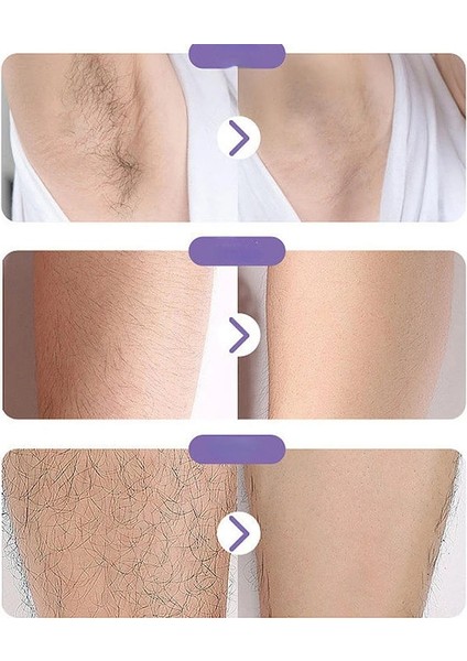 Siyah Stil Fiziksel Kristal Epilasyon Ağrısız Güvenli Epilatör Kolay Temizlik Yeniden Kullanılabilir Vücut Epilasyon Aracı Cam Epilasyon Güzellik Aracı (Yurt Dışından) indirimleri