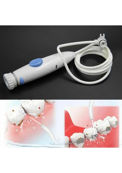 Beyaz Stil Diş Pensesinde Diş Su Jeti Yedek Tüp Hortum Kolu Model Ip Oc Waterpik WP-100 Yalnızca (Yurt Dışından)