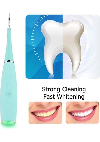 Yeşil Stil Elektrikli Ultrasonik Sonic Diş Ölçekleyici Diş Taşı Plak Sökücü Aracı Lekeleri Tartar Temiz Diş Beyazlatmak (Yurt Dışından) fiyatları