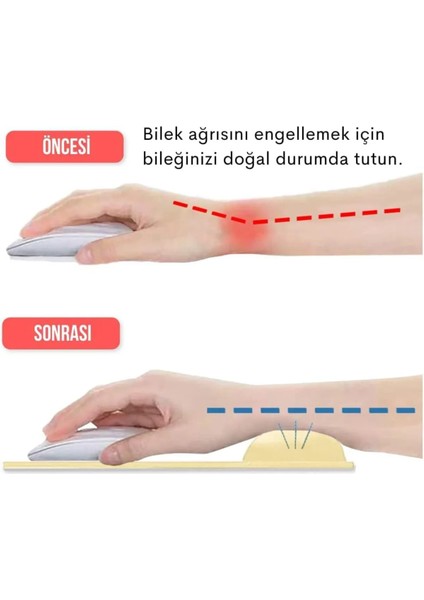 Mouse Pad Jel Dolgulu Bilek Destekli Mousepad Fare Altlığı Çeşitli Renk Seçenekleri