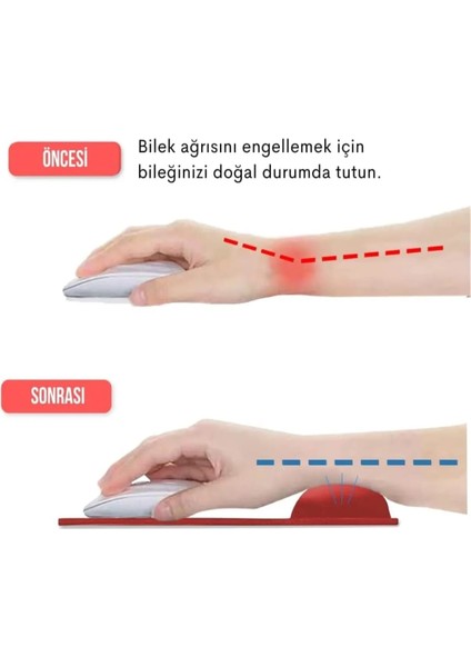 Mouse Pad Jel Dolgulu Bilek Destekli Mousepad Fare Altlığı Çeşitli Renk Seçenekleri