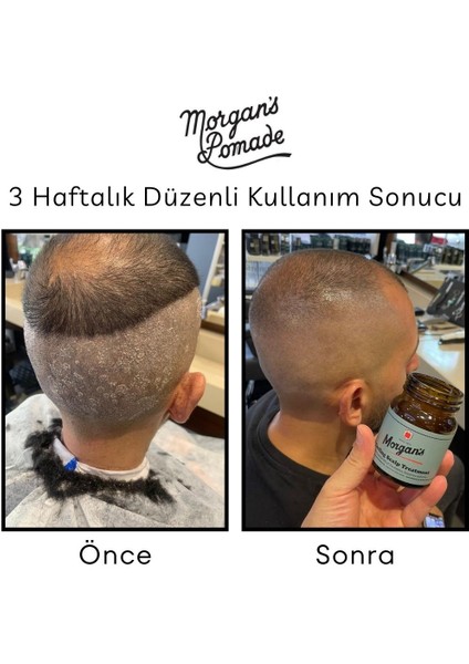 Cooling Scalp Treatment - Egzama Kepek Karşıtı Baş Derisi Bakım Tedavisi 100 gr