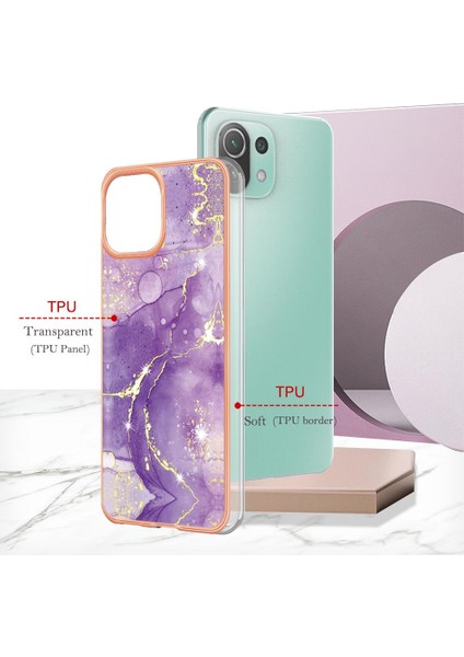 Xiaomi 11 Lite Için Kılıf (Yurt Dışından) modelleri