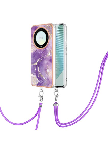 Onur Için Kılıf Sihirli 5 Lite Crossbody Kordon Askısı Mermer Anti-Scratch (Yurt Dışından)