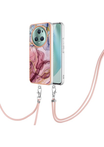 Onur Magic 5 Pro Için Durum (Yurt Dışından) indirimleri