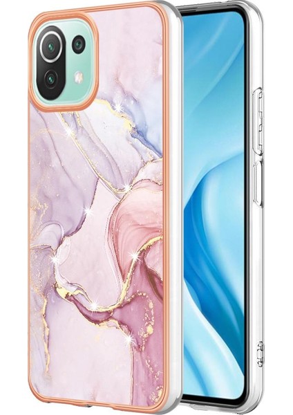 Xiaomi 11 Lite Için Kılıf (Yurt Dışından)