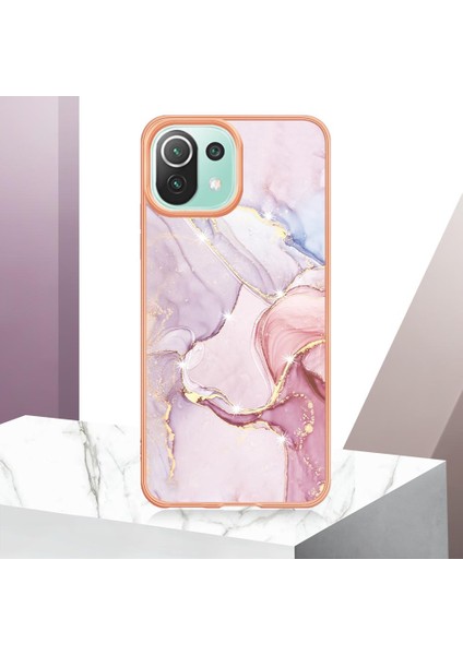 Xiaomi 11 Lite Için Kılıf (Yurt Dışından) modelleri