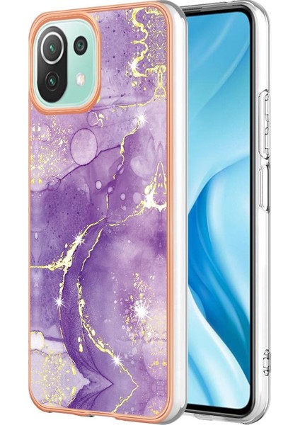 Xiaomi 11 Lite Için Kılıf (Yurt Dışından)