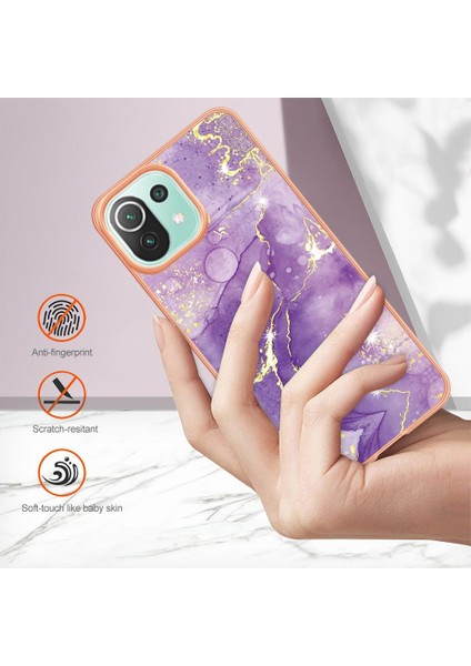 Xiaomi 11 Lite Için Kılıf (Yurt Dışından) indirimleri