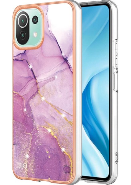 Xiaomi 11 Lite Için Kılıf (Yurt Dışından)