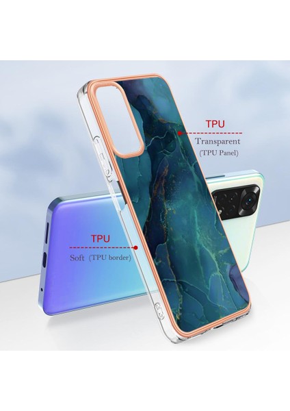 Xiaomi Redmi Not 11 4g Kılıf ile Uyumlu (Yurt Dışından)