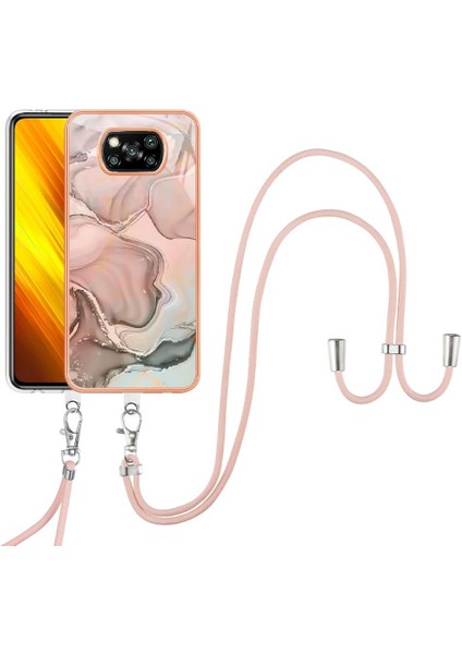 Xiaomi Poco X3/x3 Pro Kapak Mermer Yumuşak Tpu Tampon Ayrılabilir (Yurt Dışından)