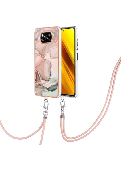 Xiaomi Poco X3/x3 Pro Kapak Mermer Yumuşak Tpu Tampon Ayrılabilir (Yurt Dışından) modelleri