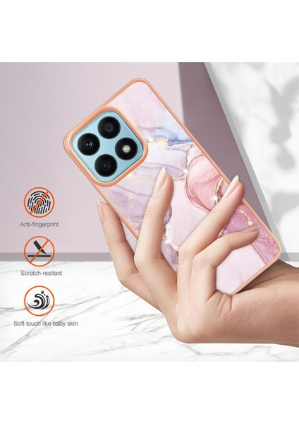 Onur X8A Için Durum (Yurt Dışından) modelleri