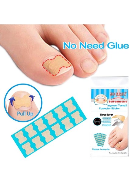 Buyfun Batık Ayak Tırnağı Düzeltici Çıkartma Ayak (Yurt Dışından)