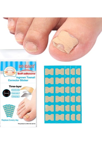 Buyfun Batık Ayak Tırnağı Düzeltici Çıkartma Ayak (Yurt Dışından)