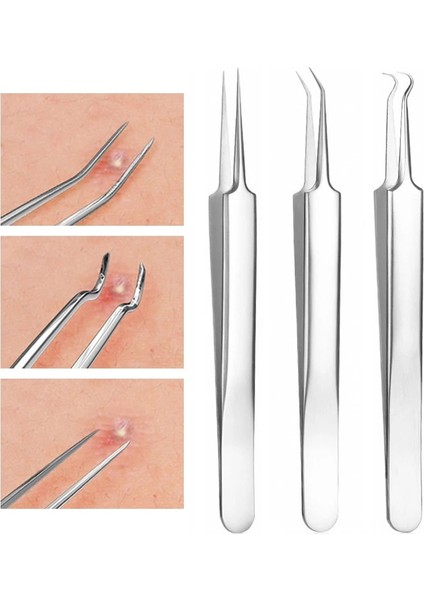 Bir Stil Paslanmaz Çelik Klipleri Kanca Iğneler Komedoncımbız Yüz Cilt Bakımı Araçları (Yurt Dışından) modelleri
