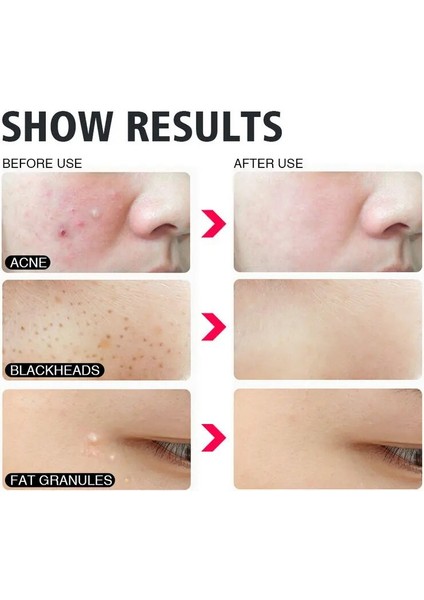 Rs Tarzı Et Profesyonel Remover Güzellik Kadın Cilt Bakımı Yüz Temizleme Aracı Kiti (Yurt Dışından) fırsatları