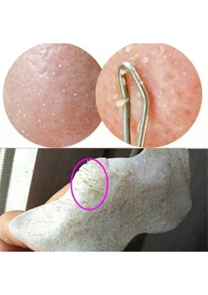60 Adet-Siyah Tarzı Unisex Siyah Nokta Çıkarıcı Maske Kabuğu Burun Bandı Derin Temizlik Gözenek Küçültmek Burun Siyah Kafa Çıkartmalar Kaldırmak Cilt Bakımı Maskesi Yama (Yurt Dışından) modelleri