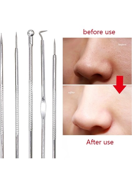 Ba2 Remover Aracı Kiti Comedone Iğne Klipsi Cımbız Leke Çıkarıcı Yüz Bakımı Aracı (Yurt Dışından)