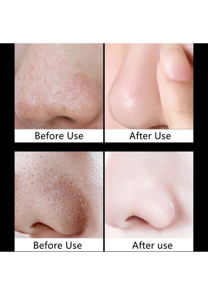 5 Adet Tarzı 20G Yüz Remover Maske Krem Cilt Bakımı Burun Temizleme (Yurt Dışından) fırsatları