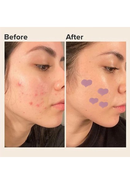 No.4 Stili Yamalar Noktalar Işaretleri Kapatıcı Onarım Etiket Su Geçirmez (Yurt Dışından) fırsatları