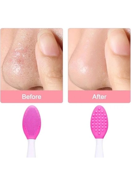 Sarı Stil 1 Adet Güzellik Cilt Bakımı Yıkama Yüz Silikon Fırça Peeling Burun Temiz Siyah Nokta Temizleme Fırçaları Araçları Yedek Kafa ile (Yurt Dışından)