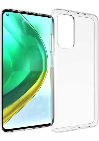 Xiaomi Mi 10T Uyumlu Lüx Seri Arka Koruma Kılıf - Şeffaf