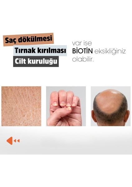 Biotin (Çinko Çörekotu Civan Perçemi At Kuyruğu Isırgan Ekstresi) 60 Kapsül