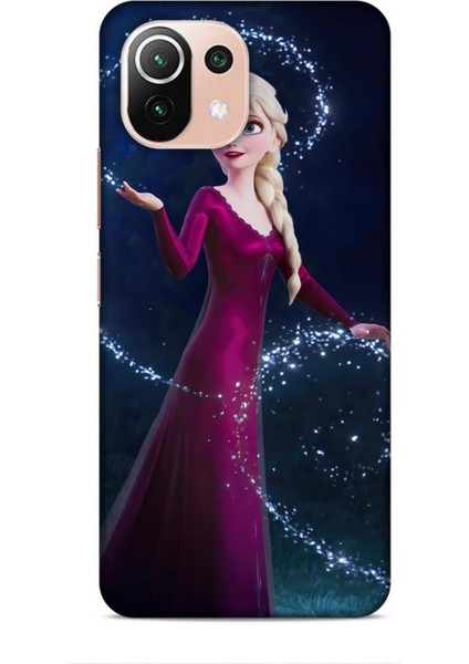 Xiaomi 11 Lite 5g Kılıf Animasyon 3 Frozen Elsa Ülkesi Bordo Arka Kapak