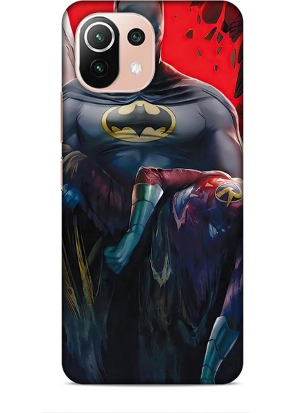 Xiaomi 11 Lite 5g Kılıf Animasyon 8 Batman Siyah Baskılı Kılıf