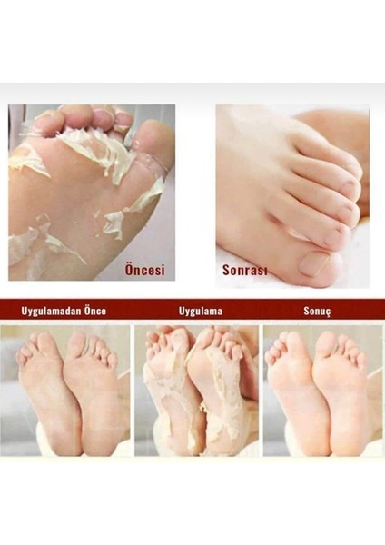 Foot Peeling Pack - Profeesıonal Çorap Tipi Ayak Peeling Maskesi,Soyulabilen ayak maskesi