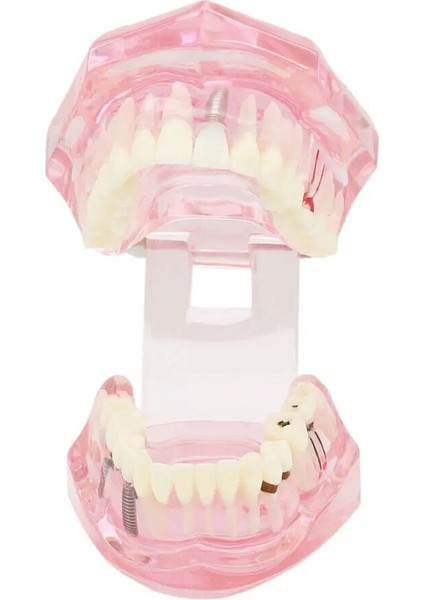 Diş Diş Modeli Öğretme Çalışması Oral Implant Restorasyonu ve Patoloji Pembe (Yurt Dışından) fiyatları