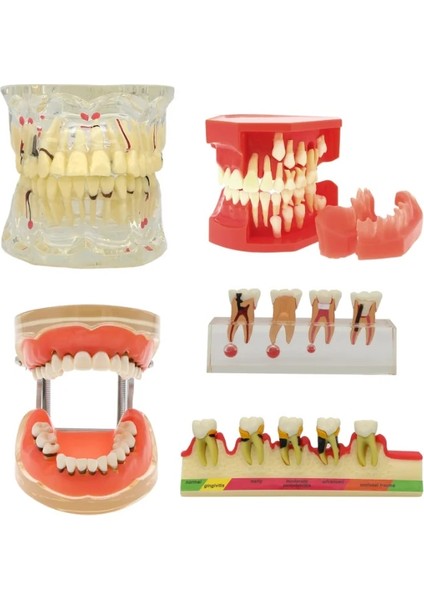 M4010 Tarzı Diş Patolojik Typodont Diş Modeli Periodontoloji Implant Endodontik Çürük Tedavisi Typodont Modeli Yetişkin Çocuk Diş (Yurt Dışından)