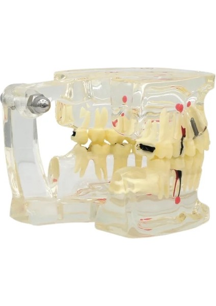 M4010 Tarzı Diş Patolojik Typodont Diş Modeli Periodontoloji Implant Endodontik Çürük Tedavisi Typodont Modeli Yetişkin Çocuk Diş (Yurt Dışından)