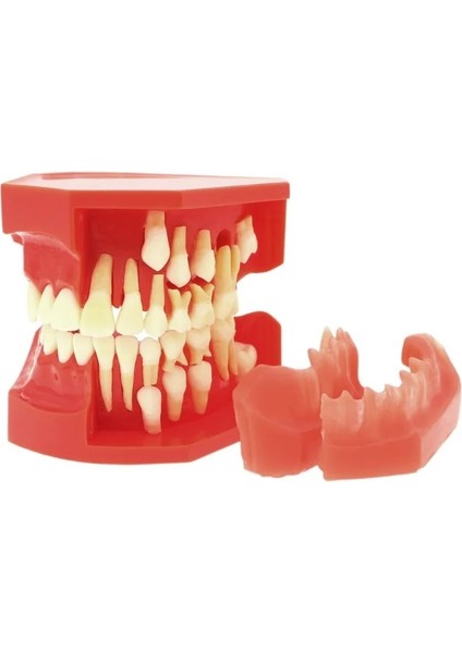 M4010 Tarzı Diş Patolojik Typodont Diş Modeli Periodontoloji Implant Endodontik Çürük Tedavisi Typodont Modeli Yetişkin Çocuk Diş (Yurt Dışından)