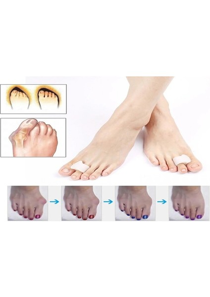 Yüzüklü Ayak Parmak Ayırıcı Makara Silikon indirimleri