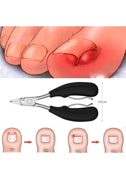 Yeni Ayak Tırnak Makası 1 Pc Tırnak Düzeltme Pense Clipper Kesiciler Ölü Cilt Kir Sökücü Pediatri Pedikür Bakım Aracı (Yurt Dışından)